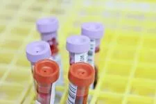 Discussing blood work and medical reports